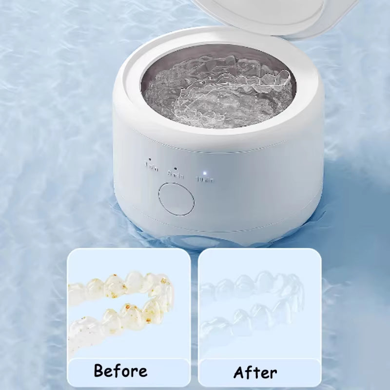 Ultrasonic Wave Cleaning Machine | Electronic Jewelry Orthodontic Cleaner